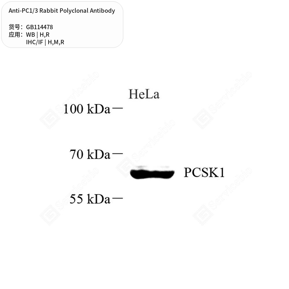 Антитела первичные, поликлональные кролика к PC1/3 крысы, мыши, человека, 50 мкл
