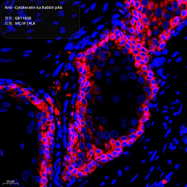 Антитела первичные, поликлональные, Cytokeratin 6a, 100 мкл