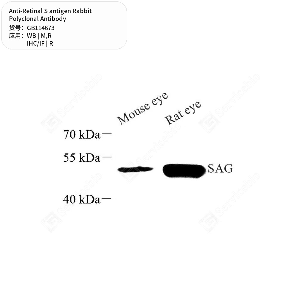 Антитела первичные, поликлональные кролика к Retinal S antigen крысы, мыши, 100 мкл