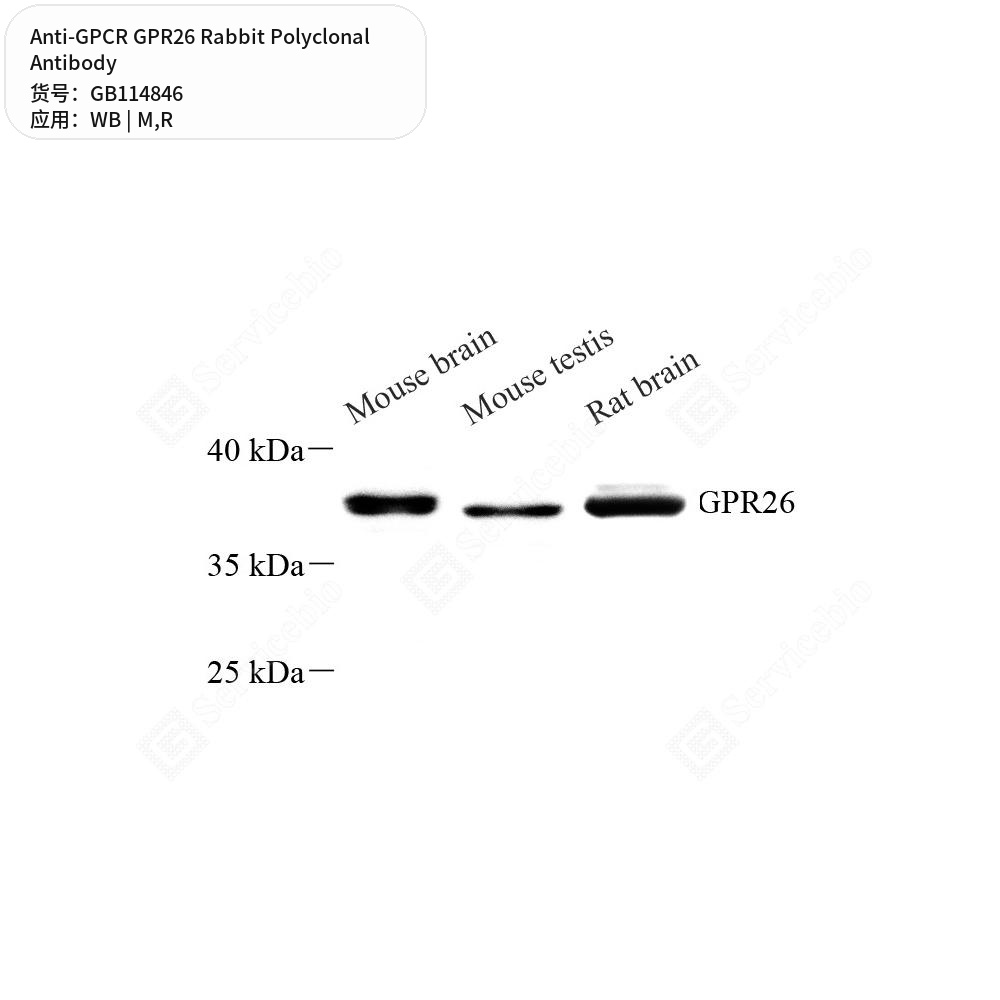 Антитела первичные, поликлональные кролика к GPCR GPR26 крысы, мыши, 50 мкл