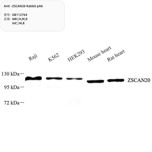 Антитела первичные, поликлональные, ZSCAN20, 100 мкл