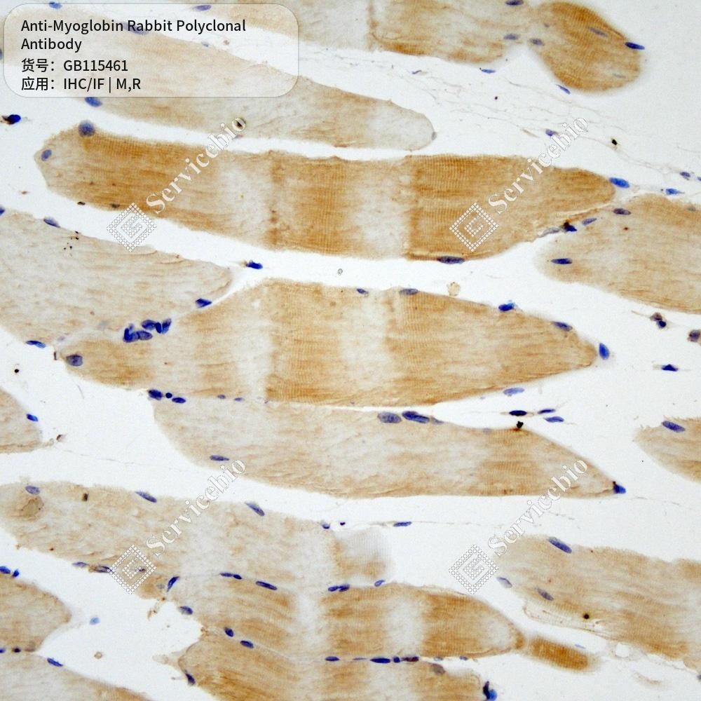 Антитела первичные, поликлональные кролика к Myoglobin крысы, мыши, 50 мкл