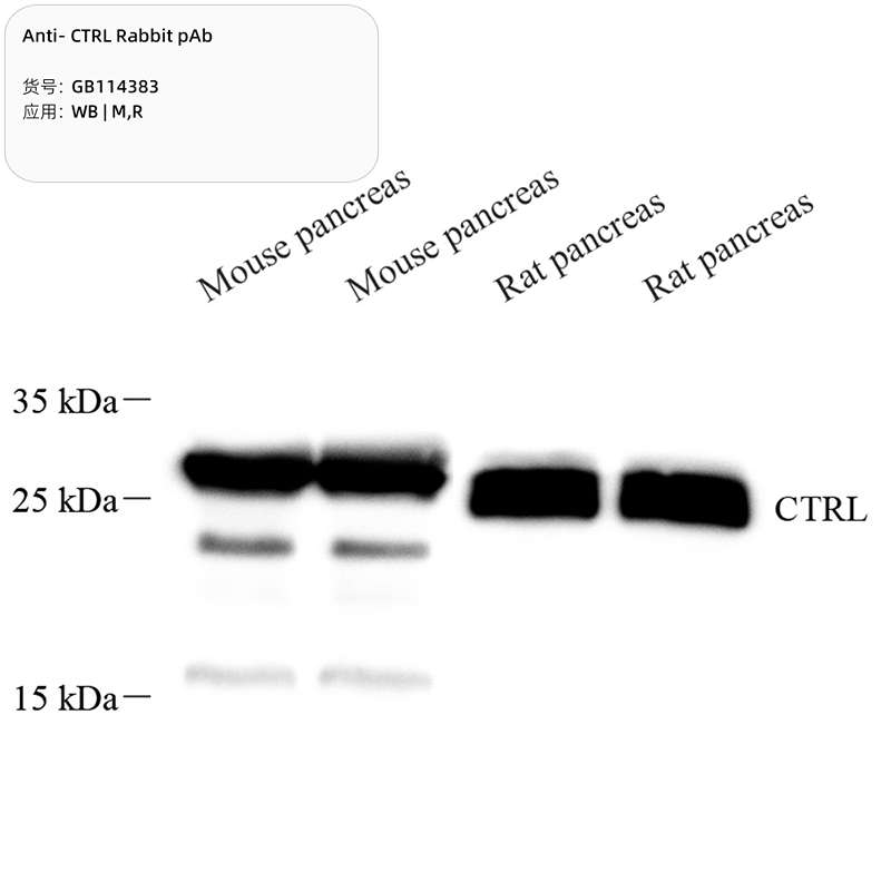 Антитела первичные, поликлональные, CTRL, 100 мкл