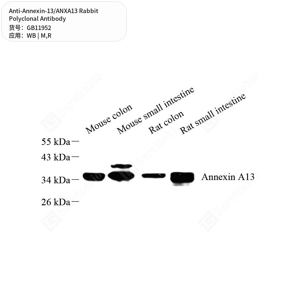 Антитела первичные, поликлональные кролика к Annexin-13/ANXA13 крысы, мыши, 50 мкл