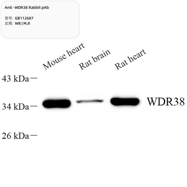 Антитела первичные, поликлональные, WDR38, 100 мкл