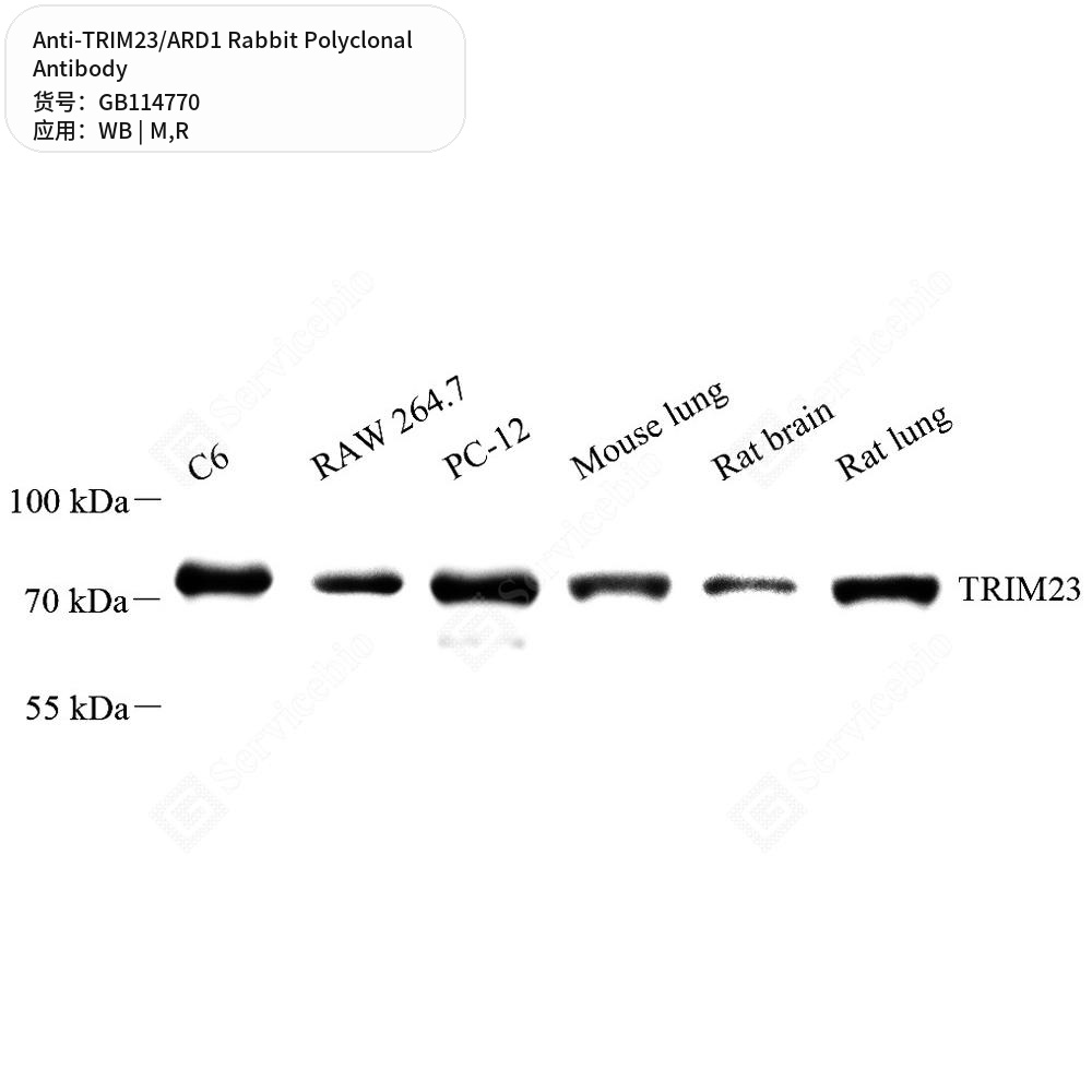 Антитела первичные, поликлональные кролика к TRIM23/ARD1 крысы, мыши, 100 мкл