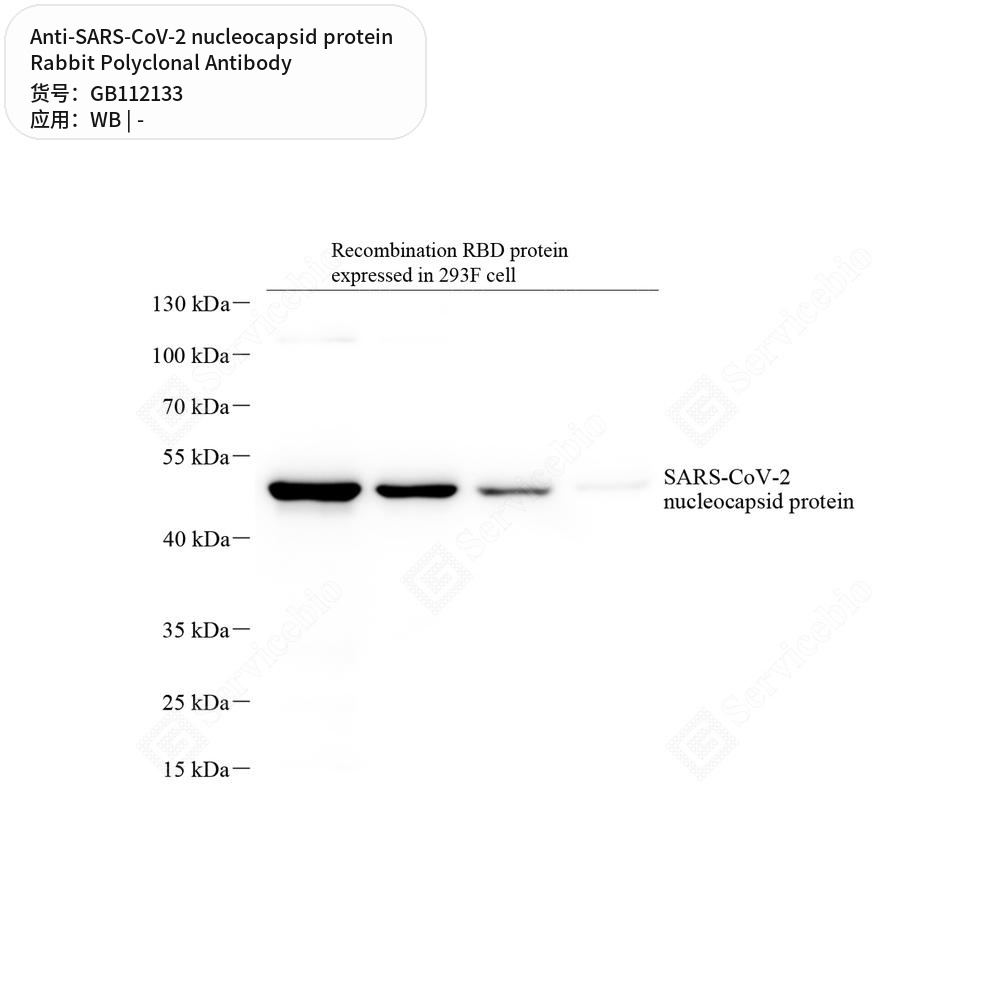 Антитела первичные, поликлональные кролика к SARS-CoV-2 nucleocapsid protein, 100 мкл