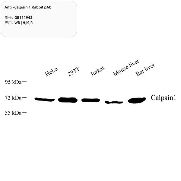 Антитела первичные, поликлональные, Calpain 1, 100 мкл