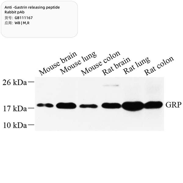 Антитела первичные, поликлональные, Gastrin releasing peptide, 100 мкл