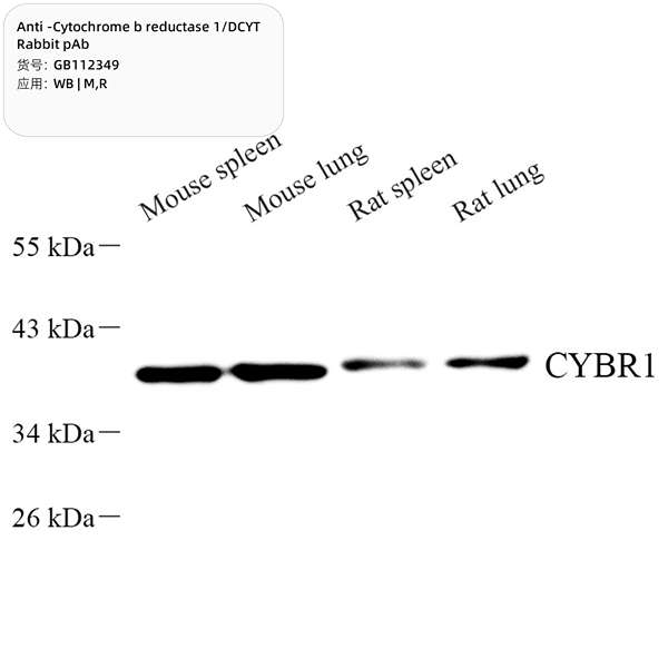 Антитела первичные, поликлональные, Cytochrome b reductase 1/DCYTB, 100 мкл