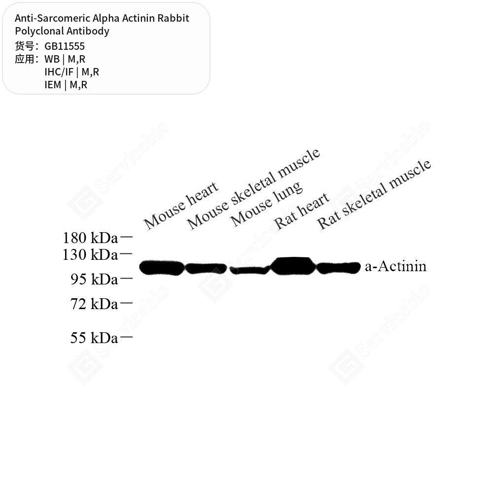 Антитела первичные, поликлональные кролика к Sarcomeric Alpha Actinin крысы, мыши, 50 мкл