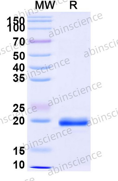 Наноантитела PorM (Nb01), 100 мкг