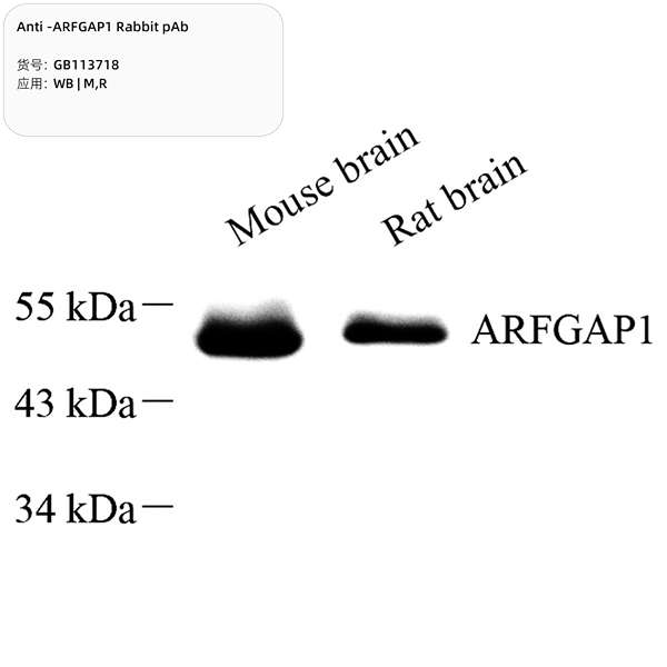 Антитела первичные, поликлональные, ARFGAP1, 100 мкл
