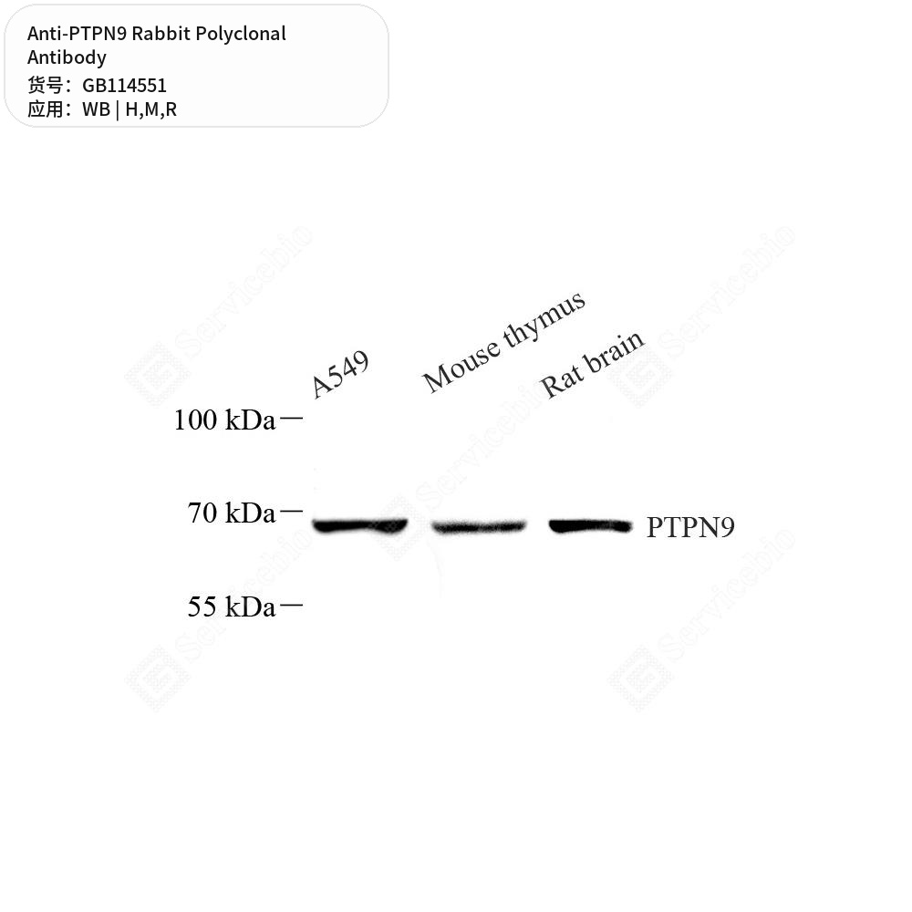 Антитела первичные, поликлональные кролика к PTPN9 крысы, мыши, человека, 50 мкл