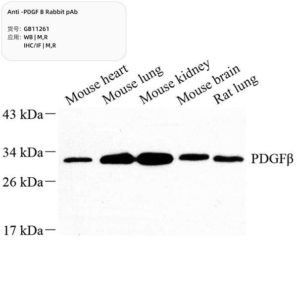 Антитела первичные, поликлональные, PDGF B, 100 мкл