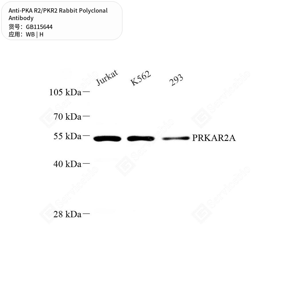 Антитела первичные, поликлональные кролика к PKA R2/PKR2 человека, 100 мкл