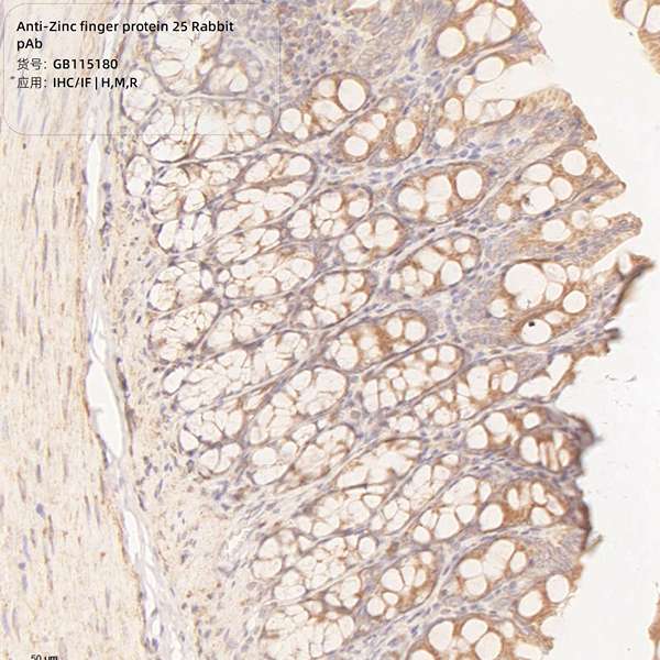 Антитела первичные, поликлональные, Zinc finger protein 25, 100 мкл