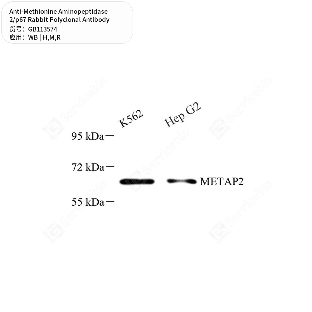 Антитела первичные, поликл. кролика к Methionine Aminopeptidase 2/p67 крысы, мыши, чел., 100 мкл