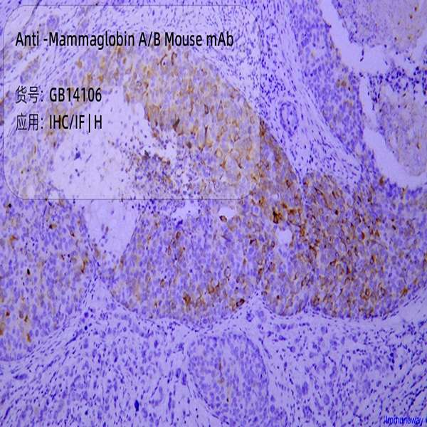 Антитела первичные, моноклональные, Mammaglobin A/B, 50 мкл
