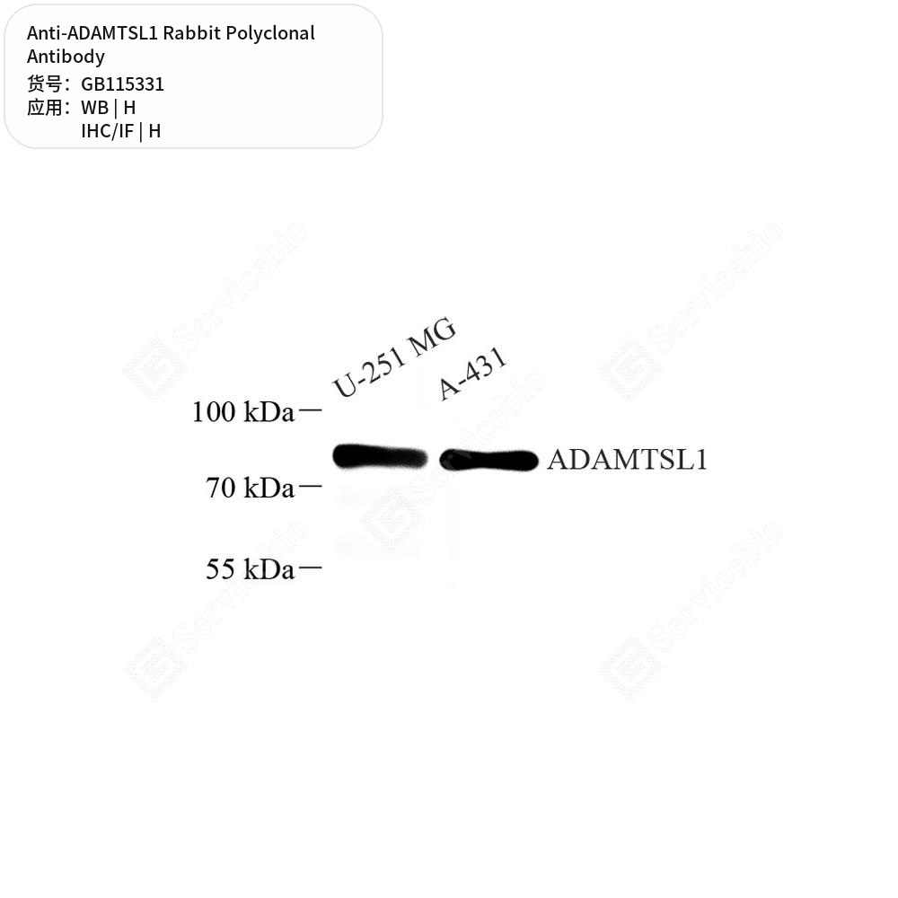 Антитела первичные, поликлональные кролика к ADAMTSL1 человека, 50 мкл