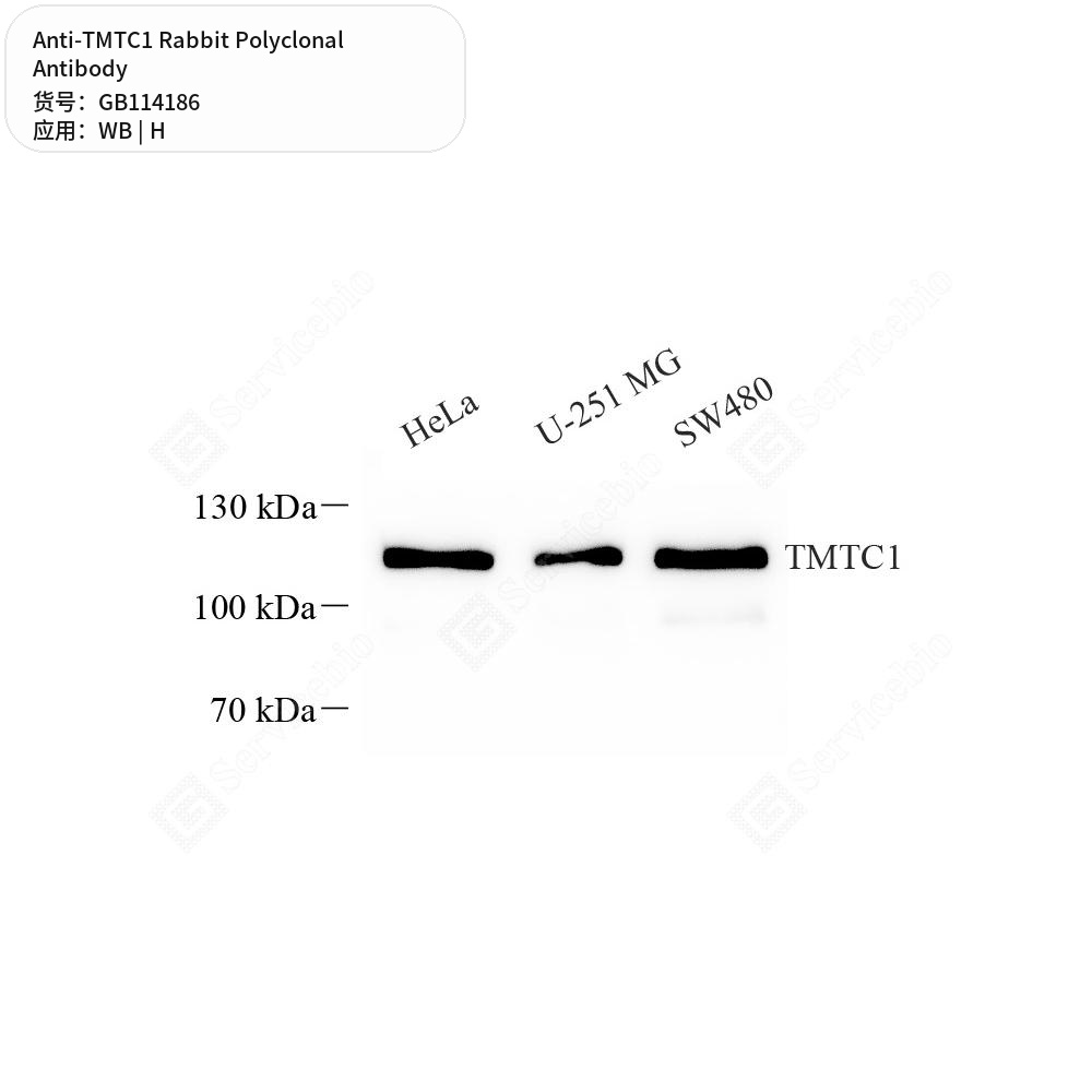 Антитела первичные, поликлональные кролика к TMTC1 человека, 50 мкл