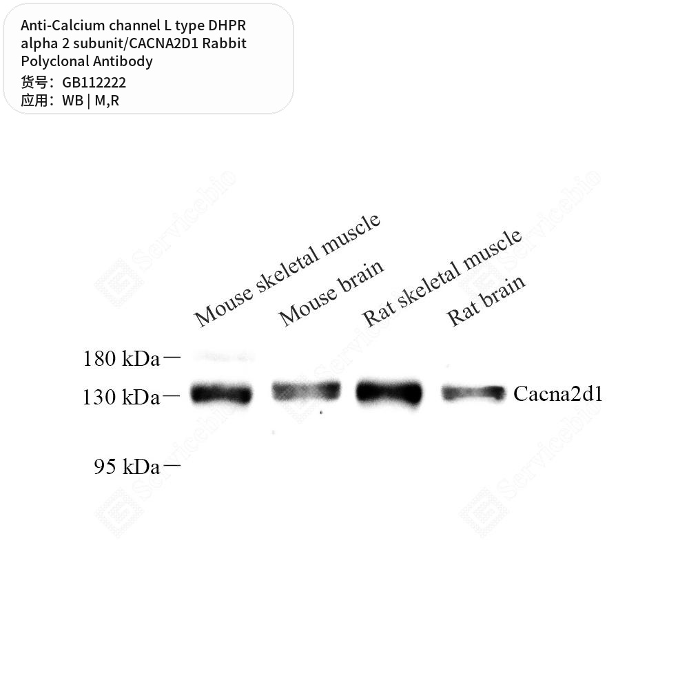 Антитела перв., полик. крол. к Calc. Chann. L type DHPR alpha 2 subunit/CACNA2D1 кр., мыши, 100 мкл