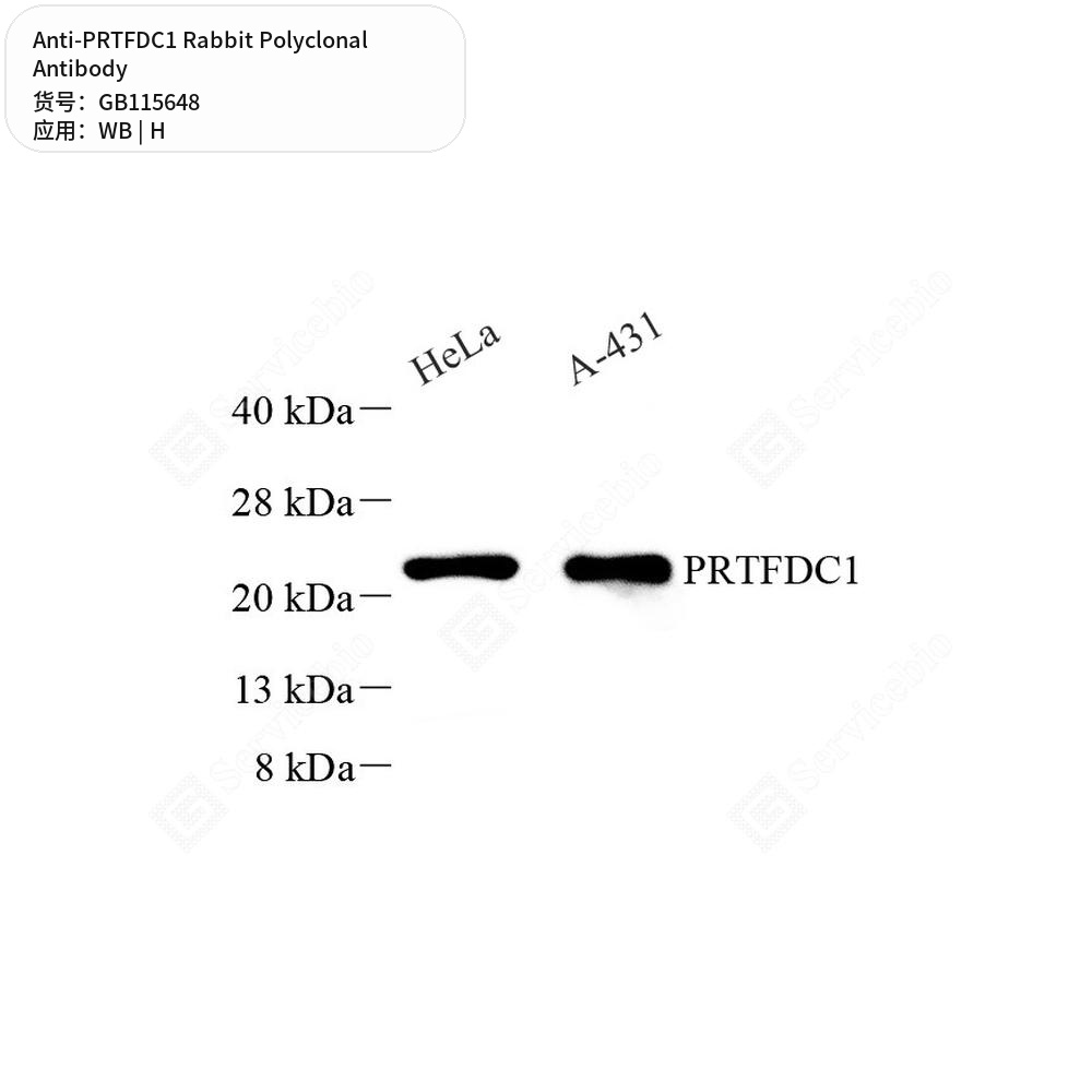 Антитела первичные, поликлональные кролика к PRTFDC1 человека, 50 мкл