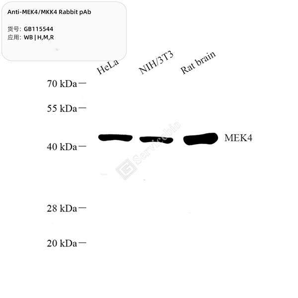 Антитела первичные, поликлональные, MEK4/MKK4, 100 мкл