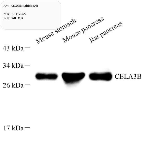 Антитела первичные, поликлональные, CELA3B, 100 мкл