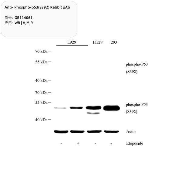 Антитела первичные, поликлональные, Phospho-p53(S392), 100 мкл