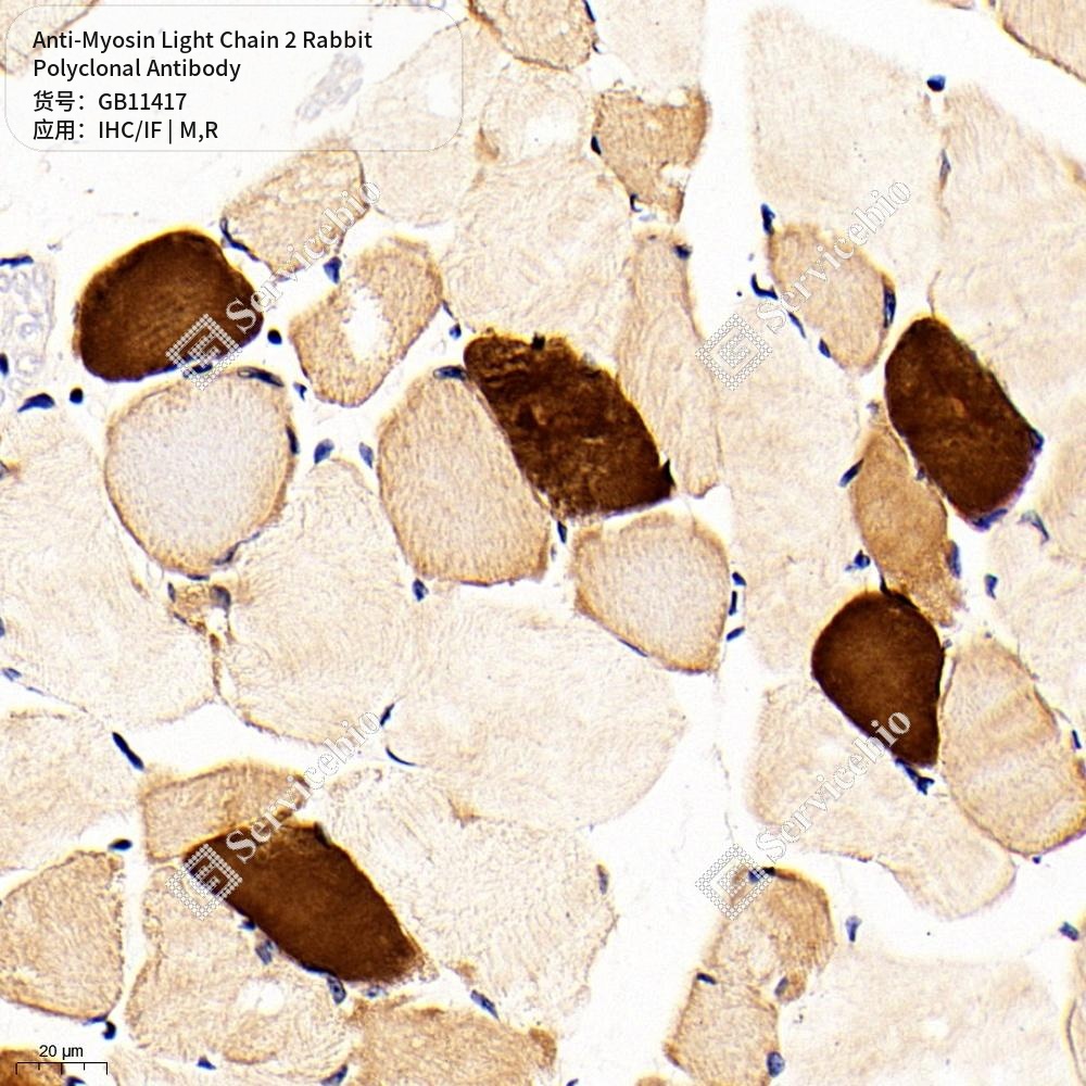 Антитела первичные, поликлональные кролика к Myosin Light Chain 2 крысы, мыши, 50 мкл