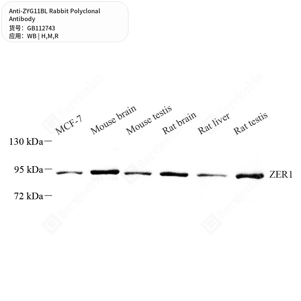 Антитела первичные, поликлональные кролика к ZYG11BL крысы, мыши, человека, 100 мкл