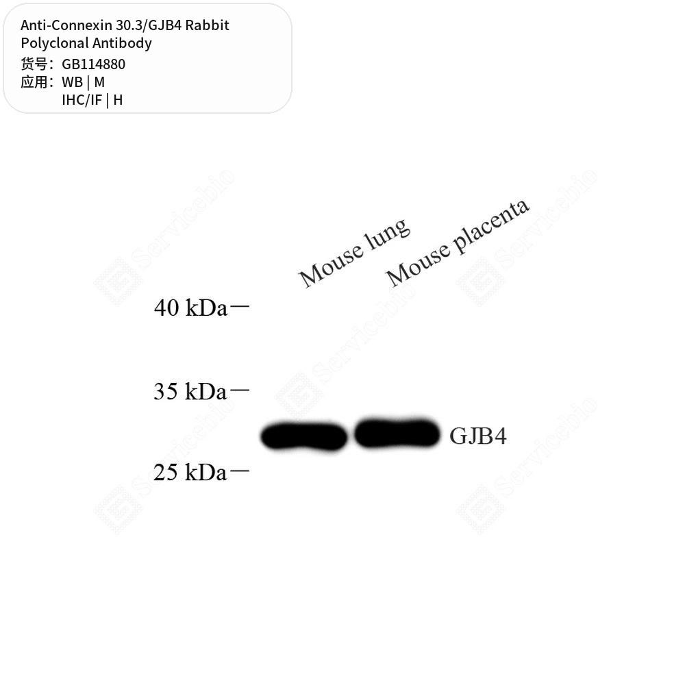 Антитела первичные, поликлональные кролика к Connexin 30.3/GJB4 мыши, человека, 100 мкл
