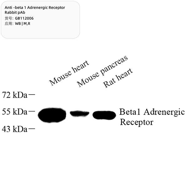 Антитела первичные, поликлональные, beta 1 Adrenergic Receptor, 100 мкл