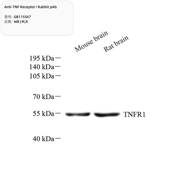 Антитела первичные, поликлональные, TNF Receptor I, 100 мкл