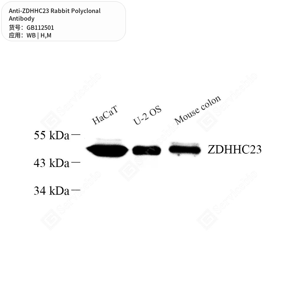 Антитела первичные, поликлональные кролика к ZDHHC23 мыши, человека, 100 мкл