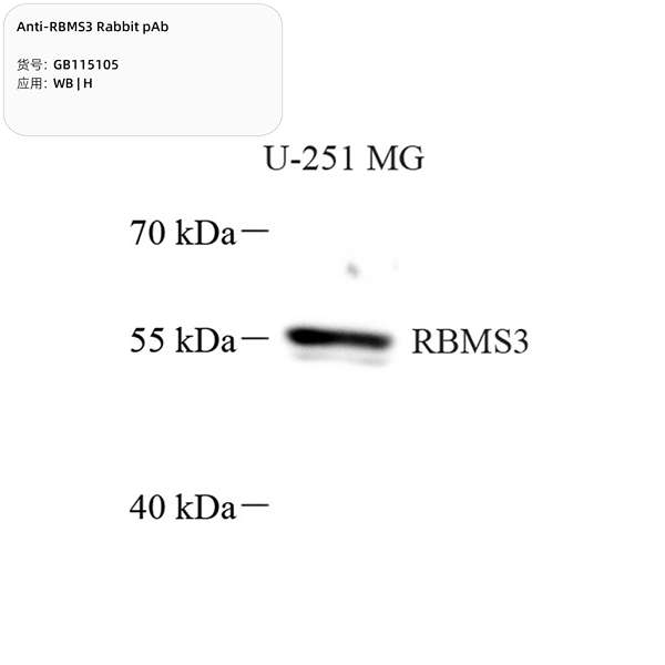 Антитела первичные, поликлональные, RBMS3, 100 мкл