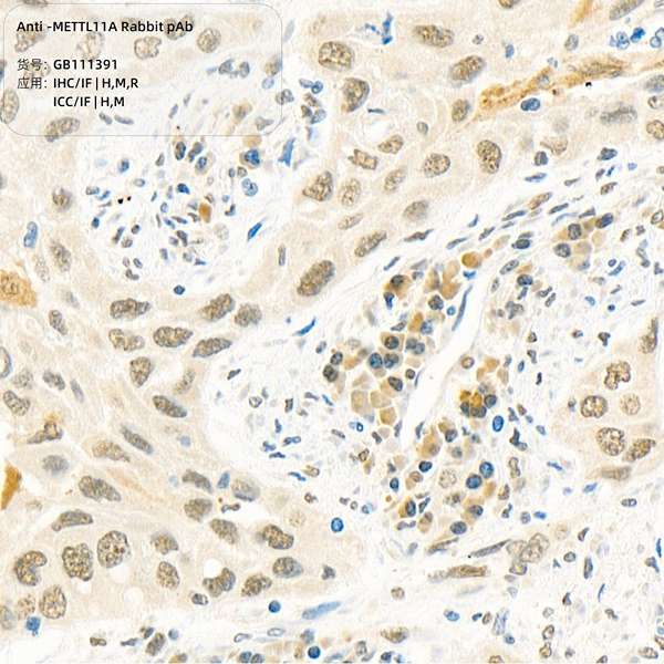 Антитела первичные, поликлональные, METTL11A, 100 мкл