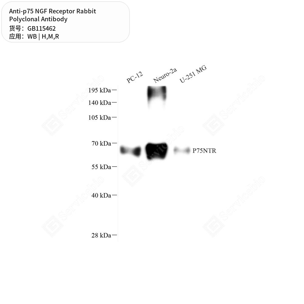 Антитела первичные, поликлональные кролика к p75 NGF Receptor крысы, мыши, человека, 50 мкл
