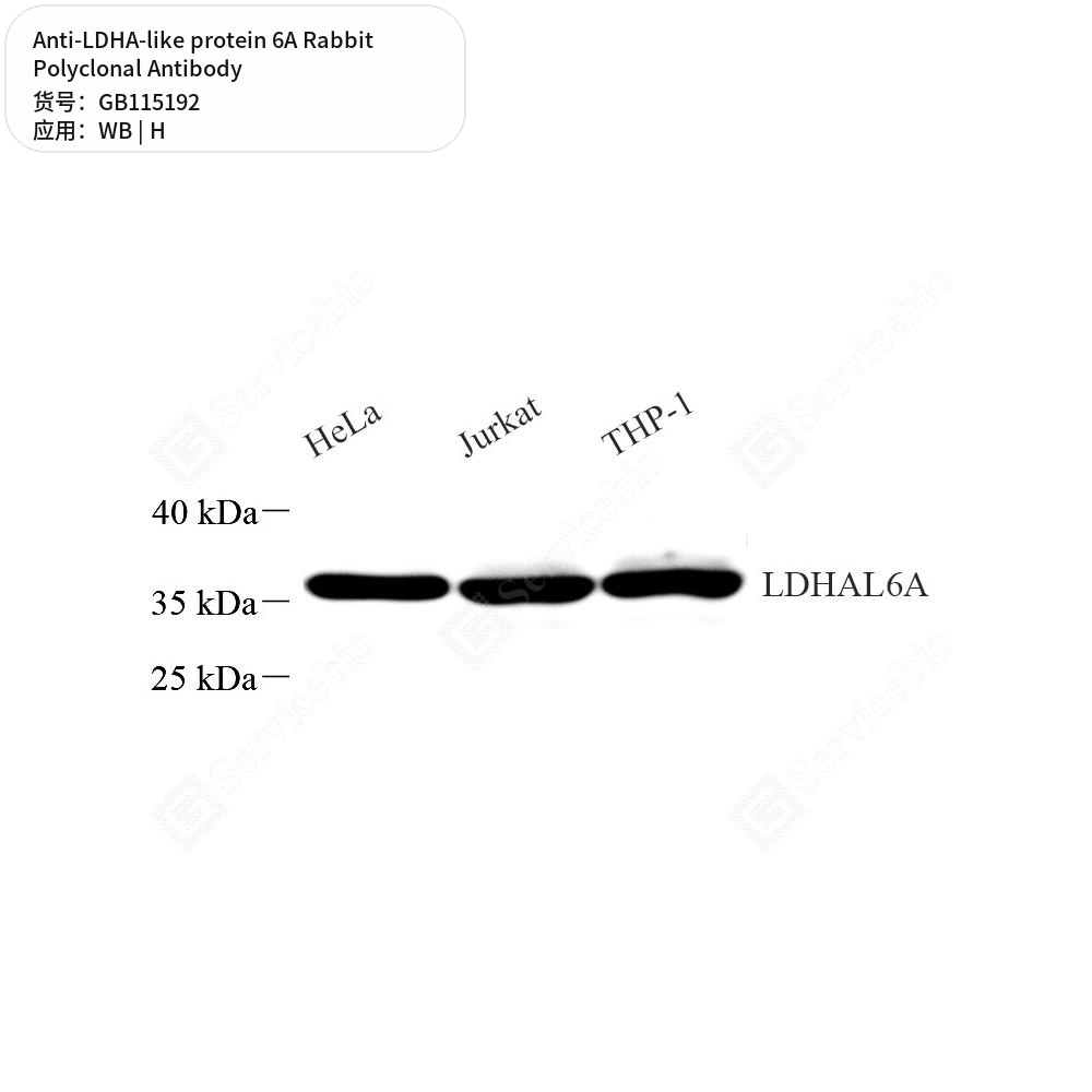 Антитела первичные, поликлональные кролика к LDHA-like protein 6A человека, 50 мкл