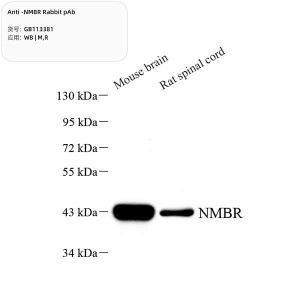 Антитела первичные, поликлональные, NMBR, 100 мкл