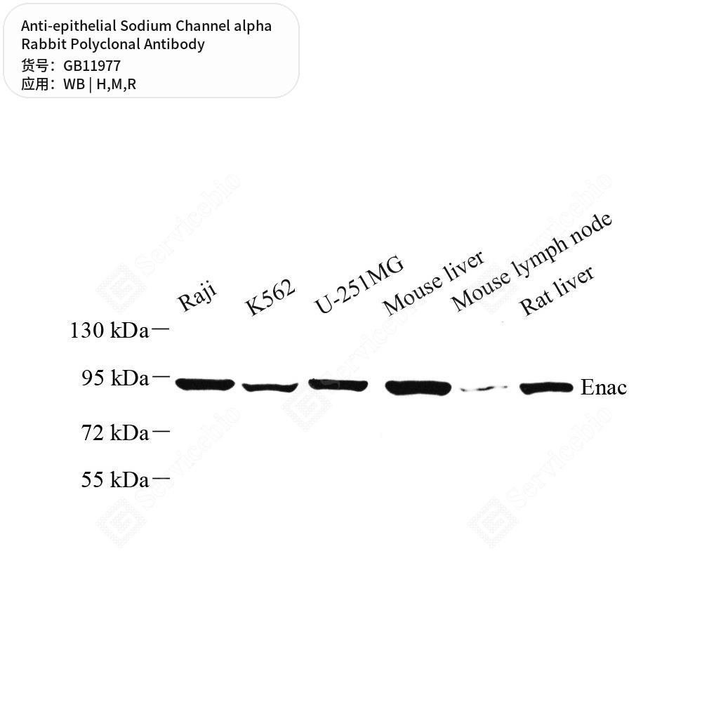 Антитела первичные, поликл. кролика к epithelial Sodium Channel alpha крысы, мыши, человека, 50 мкл