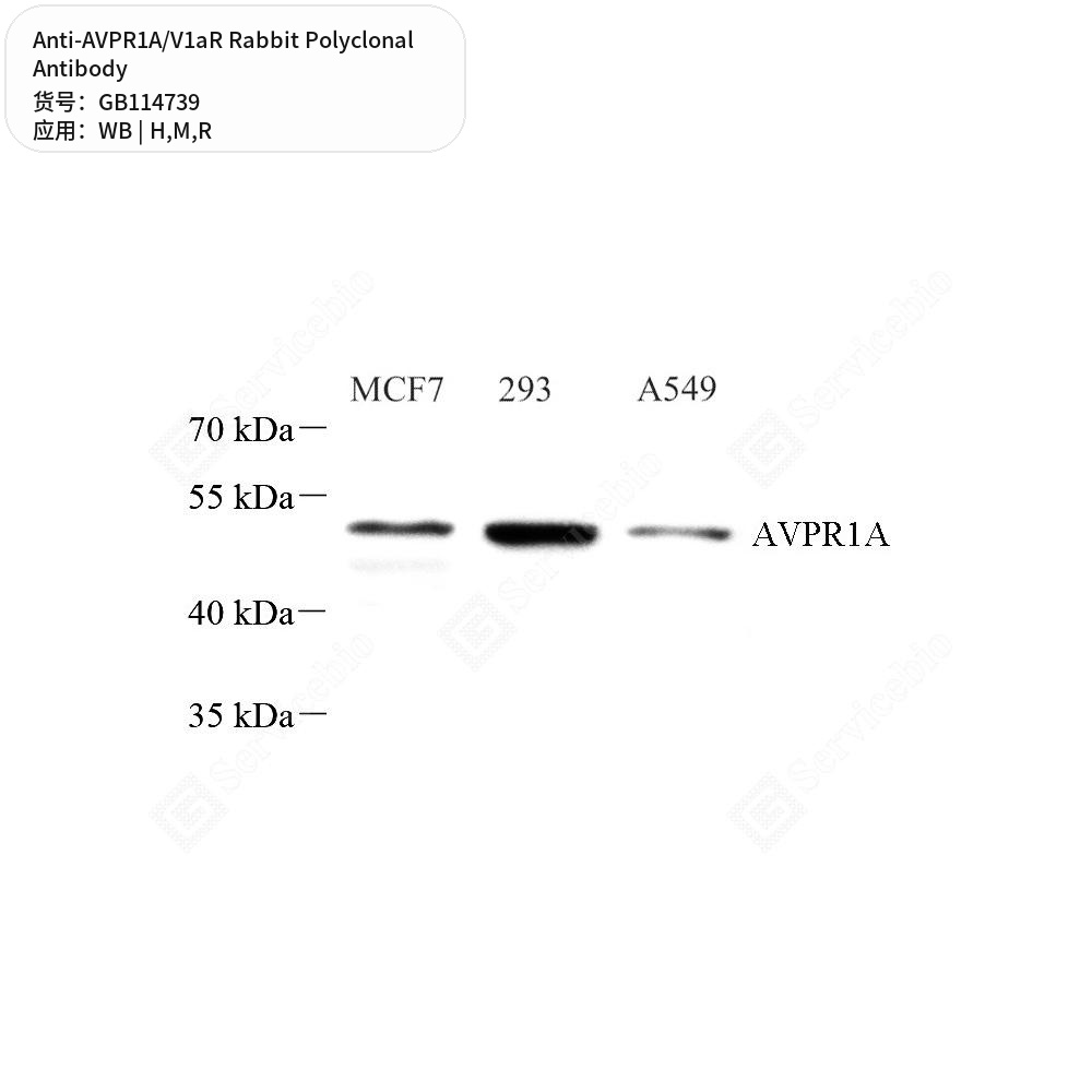 Антитела первичные, поликлональные кролика к AVPR1A/V1aR крысы, мыши, человека, 50 мкл