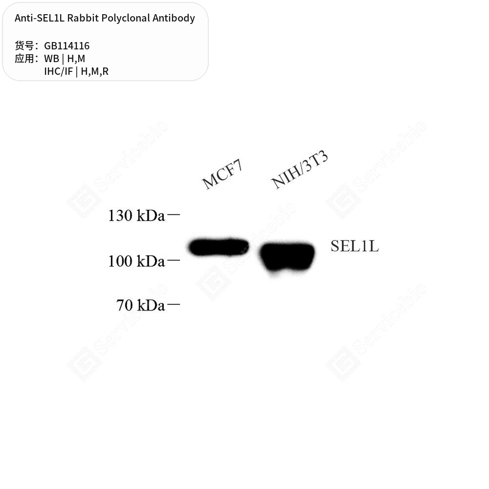 Антитела первичные, поликлональные кролика к SEL1L крысы, мыши, человека, 50 мкл