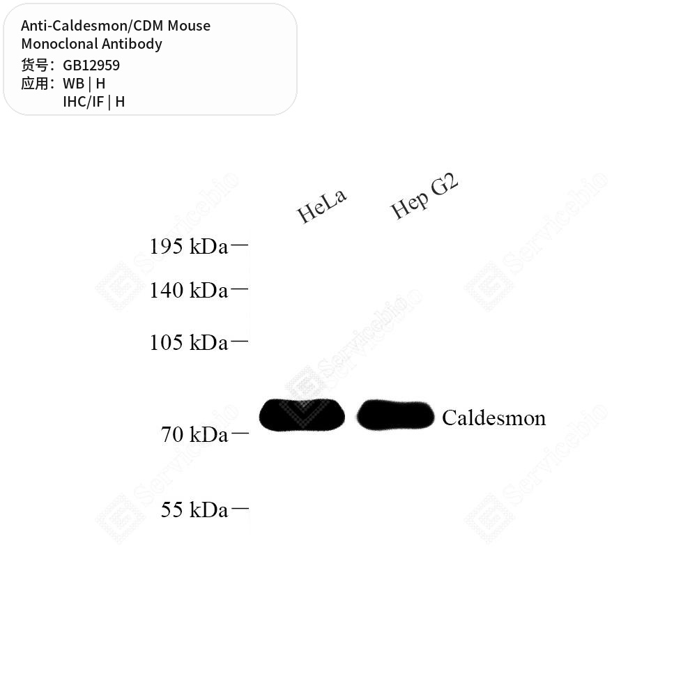 Антитела первичные, моноклональные мыши к Caldesmon/CDM человека, 50 мкл