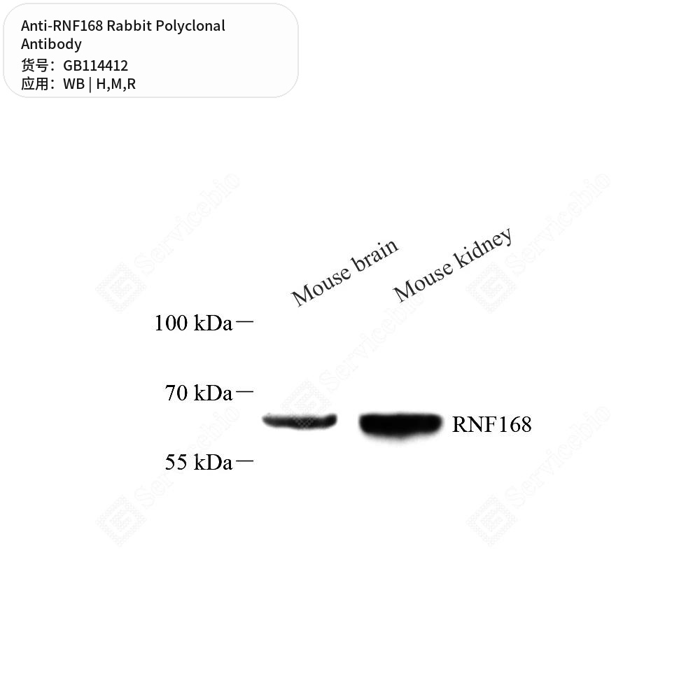 Антитела первичные, поликлональные кролика к RNF168 крысы, мыши, человека, 50 мкл