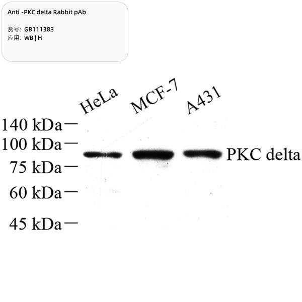 Антитела первичные, поликлональные, PKC delta, 100 мкл