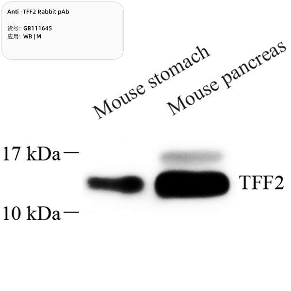 Антитела первичные, поликлональные, TFF2, 100 мкл