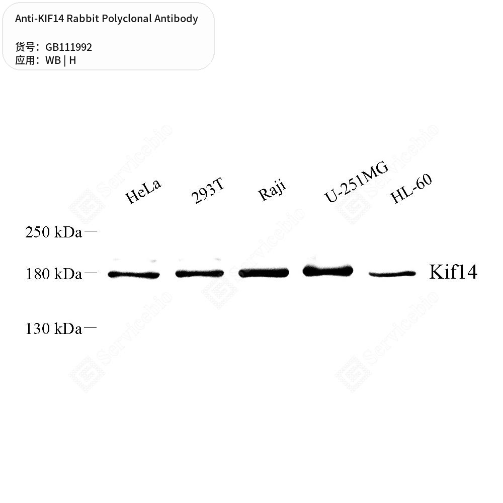 Антитела первичные, поликлональные кролика к KIF14 человека, 100 мкл