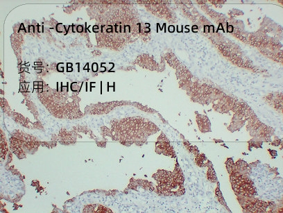 Антитела первичные, моноклональные мыши к Cytokeratin 13 человека, 50 мкл